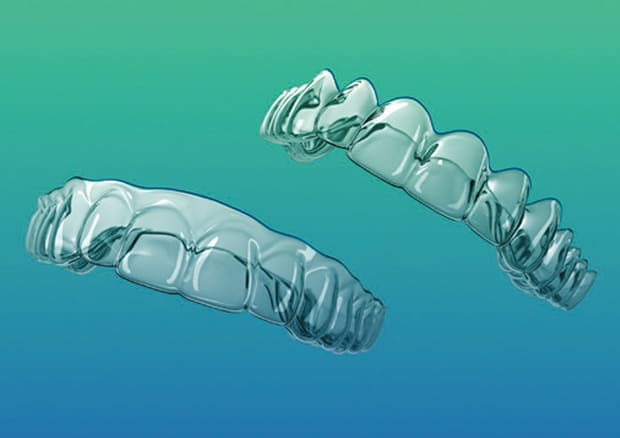 SureSmile・マウスピース矯正