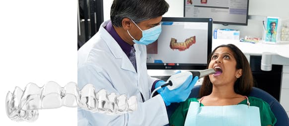 SureSmileとPrimeScan