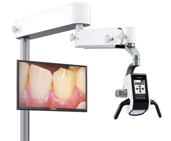 デジタルマイクロスコープネクストビジョン